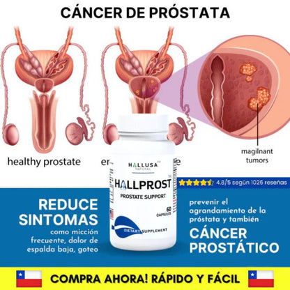 Hallprost Vital - Bienestar masculino, salud sin límites.